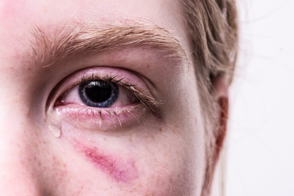 Onverwerkt trauma symptomen bij jongen